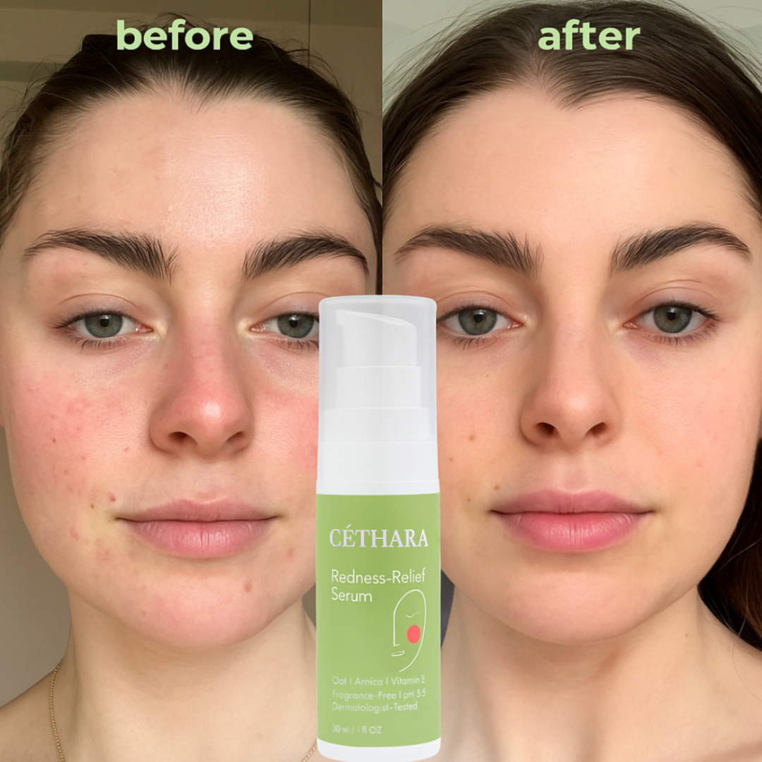 Céthara Redness Reform Serum